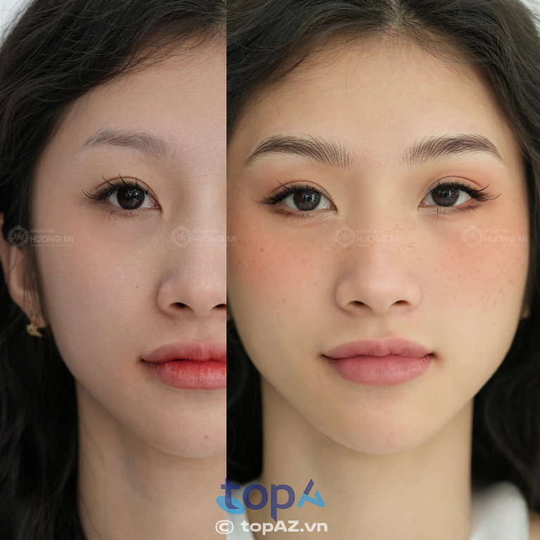 Thẩm Mỹ Viện Hương Mi