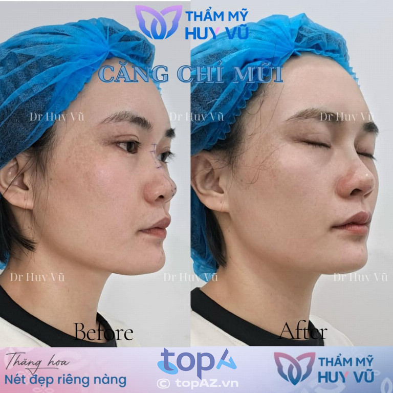 Thẩm mỹ DR Huy Vũ