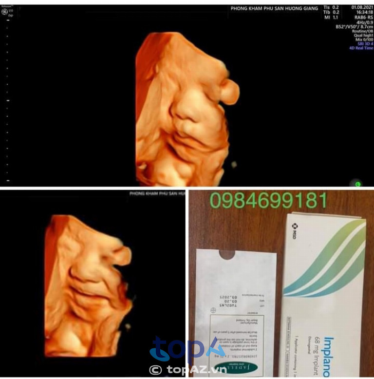 Phòng khám Phụ Sản Hương Giang - Tứ Kỳ