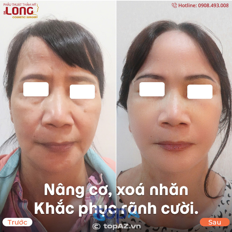Phẫu thuật thẩm mỹ BS Long - P. Vườn Lài