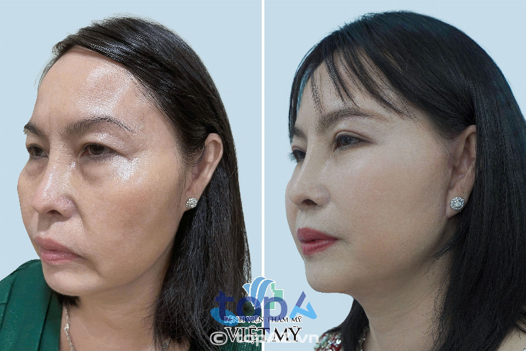 Bệnh viện Thẩm mỹ Việt Mỹ - P. Cầu Ông Lãnh