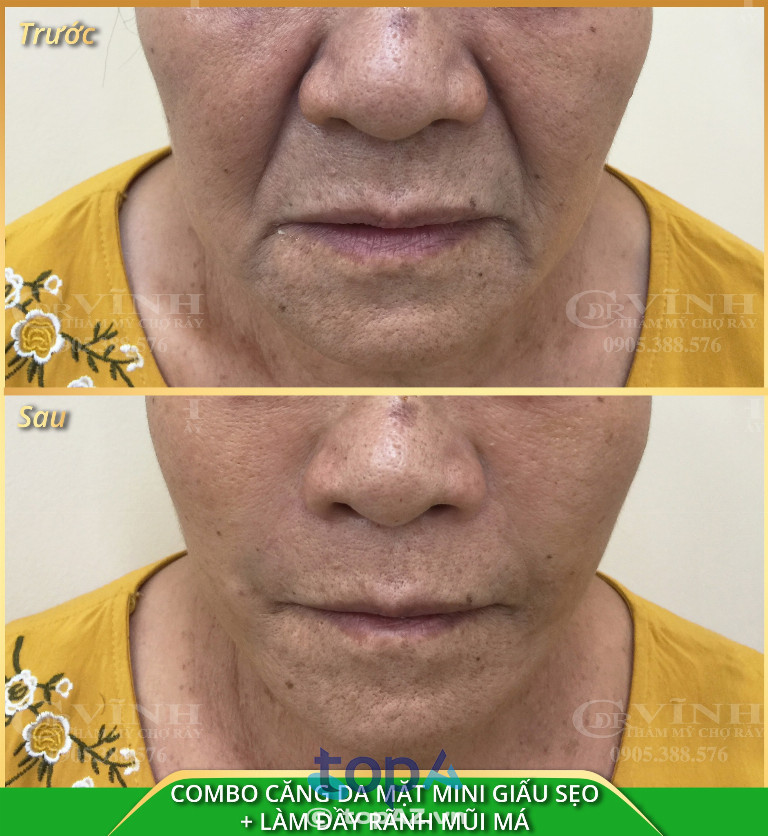 Thẩm mỹ viện DR VĨNH - Xã Bình Hưng