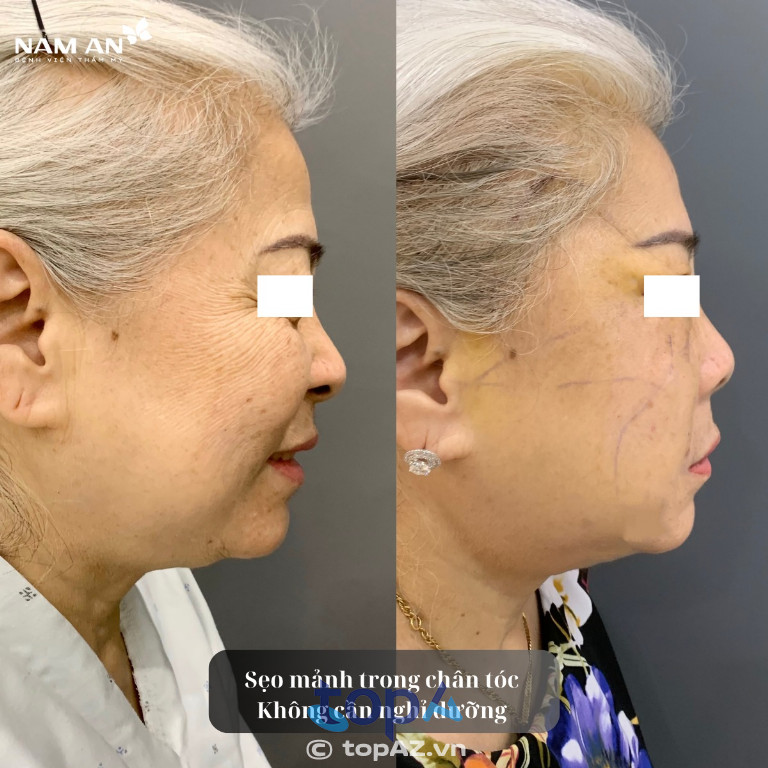 Bệnh viện thẩm mỹ Nam An - P. Vườn Lài