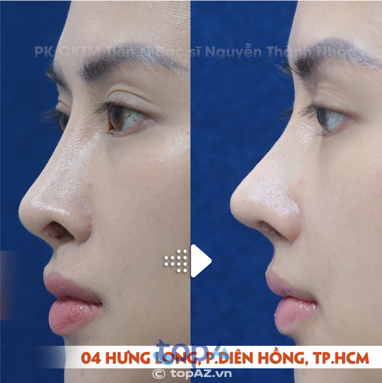 PK CK Phẫu Thuật Thẩm Mỹ TS. BS.Nguyễn Thành Nhân - P. Diên Hồng