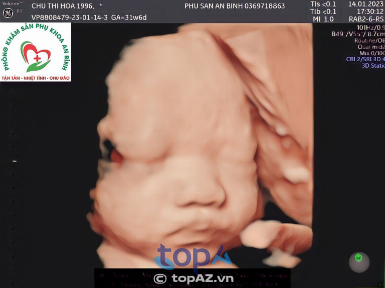 Phòng khám An Bình - Phường Nếnh