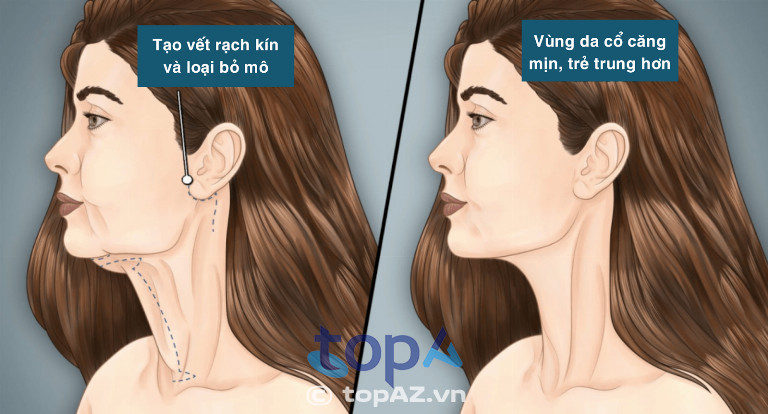 Quy trình thực hiện chuẩn y khoa