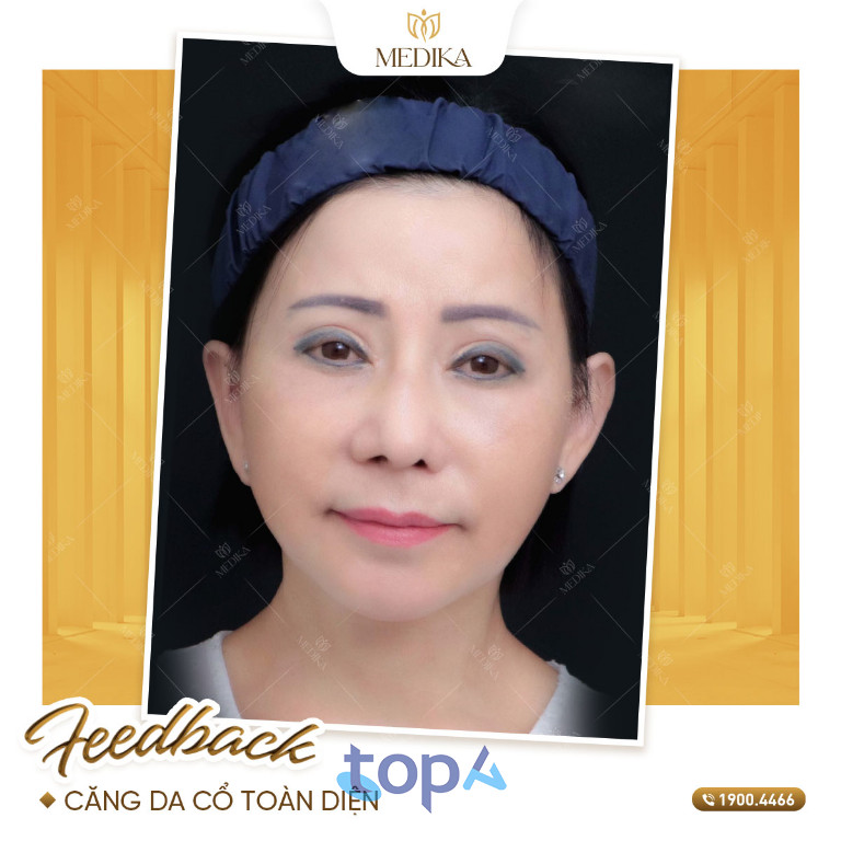 Bệnh viện Thẩm mỹ MEDIKA – P. Hòa Hưng