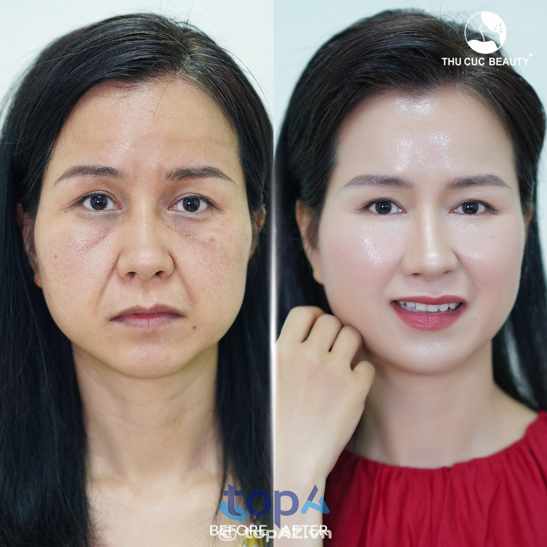 Bệnh viện Thẩm mỹ Thu Cúc – P. Xuân Hòa