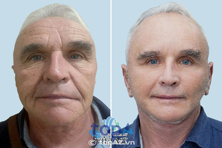 Bệnh viện Thẩm mỹ Việt Mỹ – P. Cầu Ông Lãnh