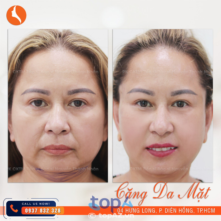 Phòng khám CK Phẫu thuật thẩm mỹ TS. BS. Nguyễn Thành Nhân - P. Diên Hồng