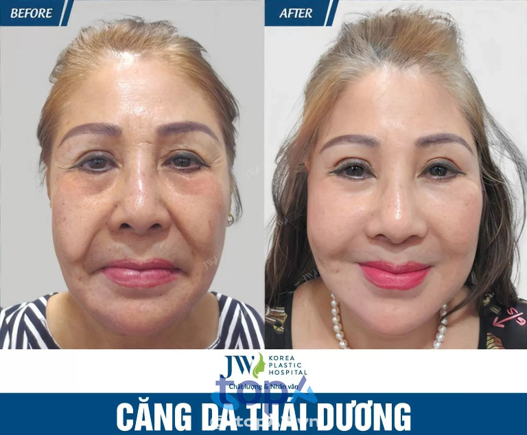 Bệnh viện JW Hàn Quốc - P. Bến Thành