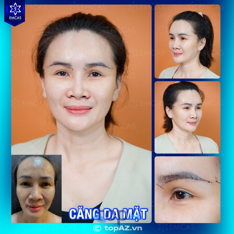 Bệnh viện Thẩm mỹ EMCAS - P. Hòa Hưng