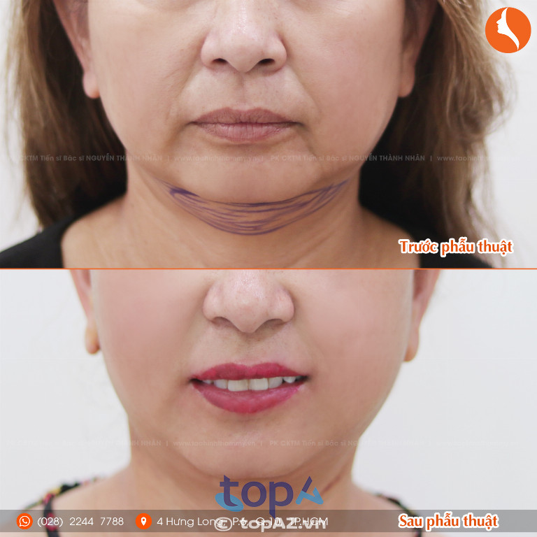 Phòng khám CK Phẫu thuật thẩm mỹ TS. BS. Nguyễn Thành Nhân – P. Diên Hồng