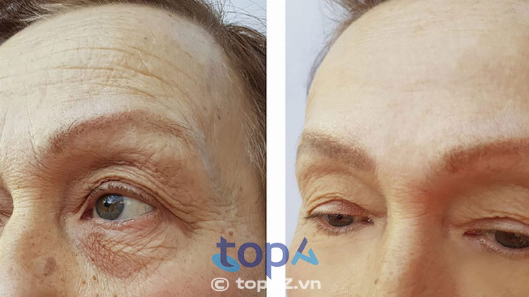 Thăm khám và tư vấn kỹ trước khi thực hiện