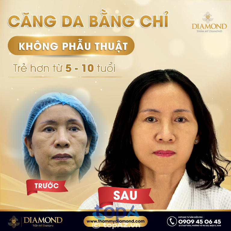 Thẩm Mỹ Công Nghệ Cao Diamond - P. Xuân Hòa