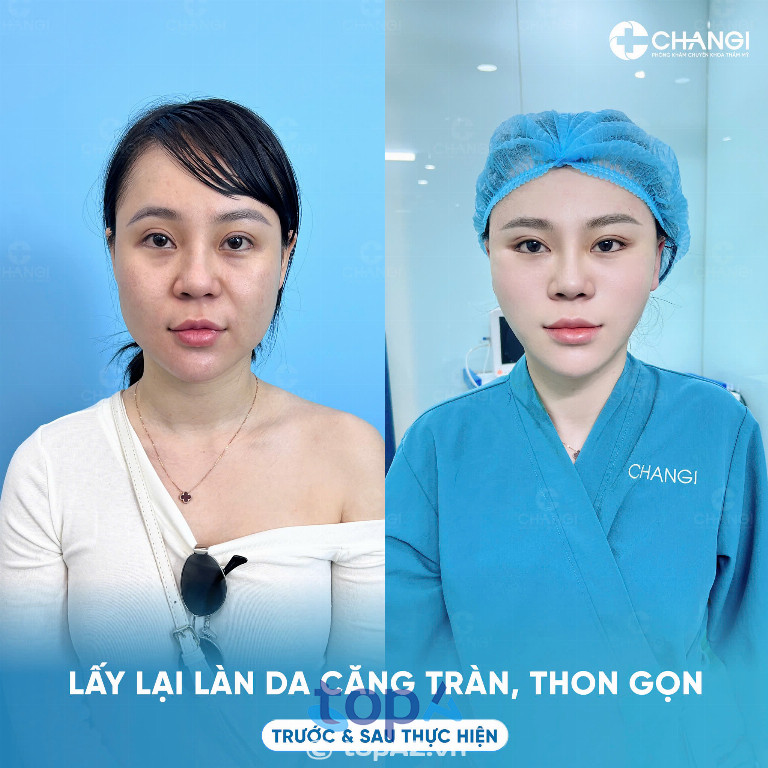 Phòng khám chuyên khoa Thẩm mỹ CHANGI - P. Tân Định
