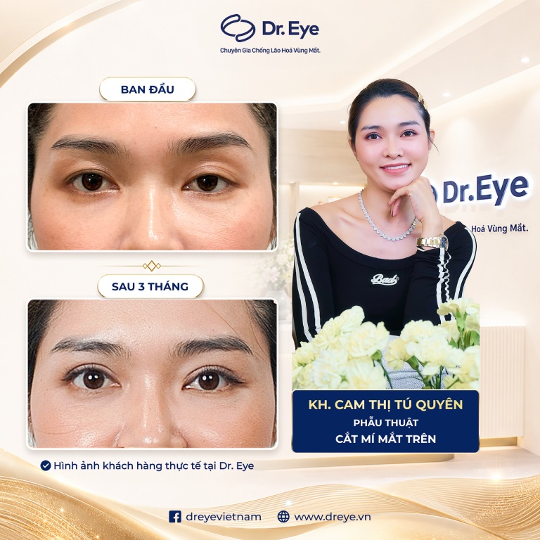 Phòng khám Chuyên khoa Thẩm mỹ Dr. Eye tại TPHCM Phòng khám Chuyên khoa Thẩm mỹ Dr. Eye tại TPHCM
