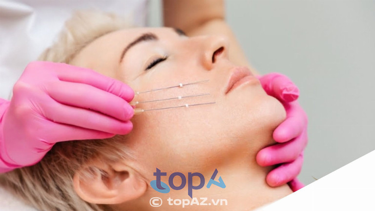 Sử dụng loại chỉ sinh học chất lượng