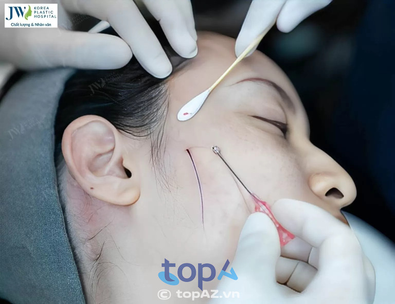 Bệnh viện Thẩm mỹ JW Hàn Quốc - P. Bến Thành