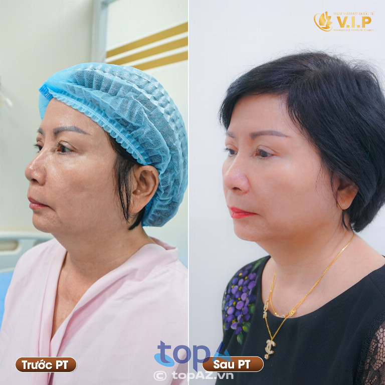Thẩm Mỹ Viện VIP - P. Cầu Ông Lãnh