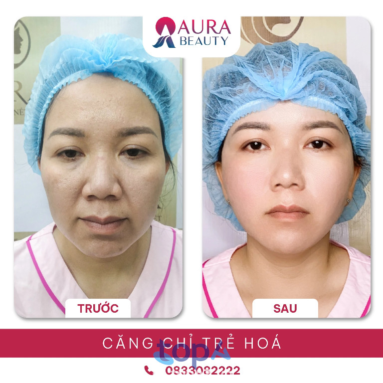 Thẩm mỹ viện Quốc tế Aura - P. Hòa Hưng