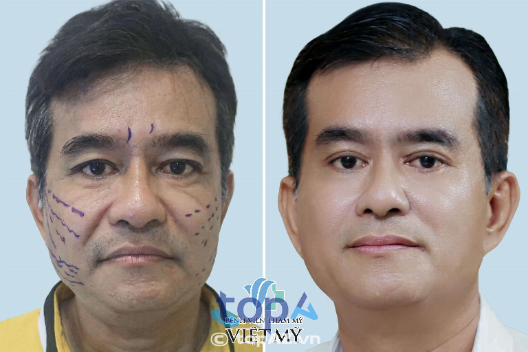 Bệnh viện Thẩm mỹ Việt Mỹ - P. Cầu Ông Lãnh