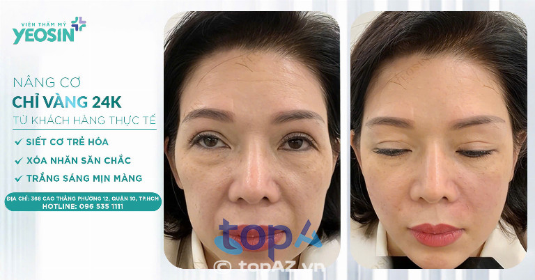 Viện thẩm mỹ Quốc tế Yeosin - P. Hoà Hưng