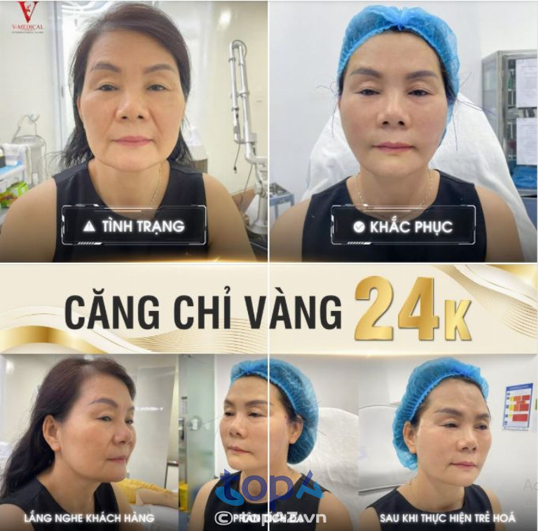 Viện thẩm mỹ V-Medical - P. Xuân Hòa