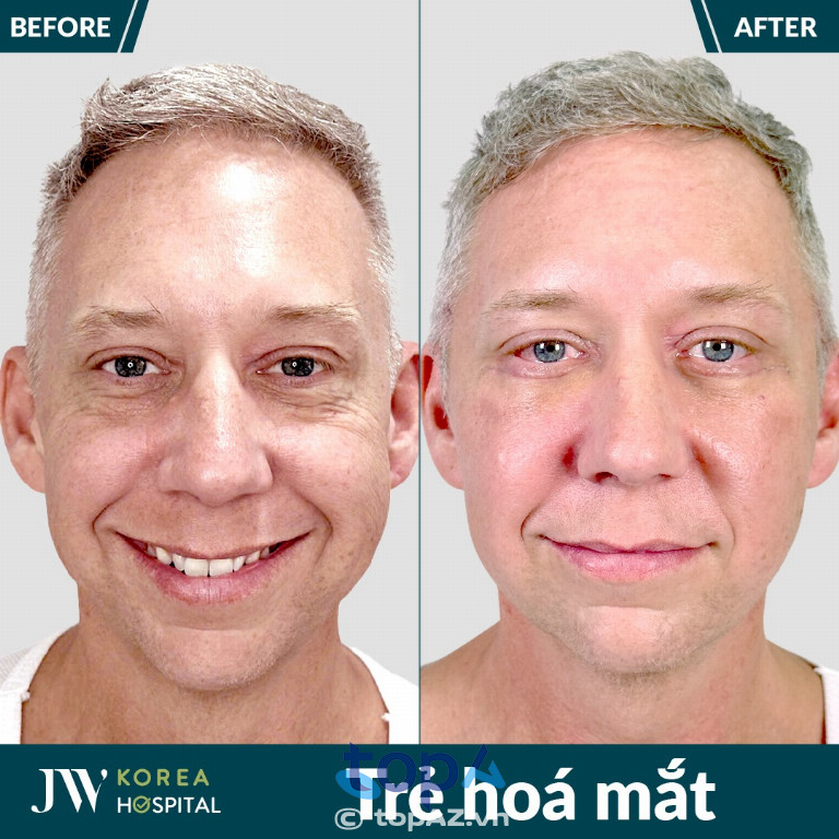 Bệnh viện Thẩm mỹ JW Hàn Quốc - P. Bến Thành