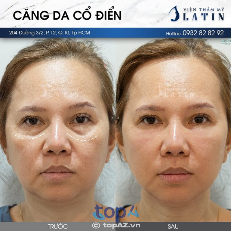 Phòng Khám Thẩm Mỹ LATIN - P. Hoà Hưng