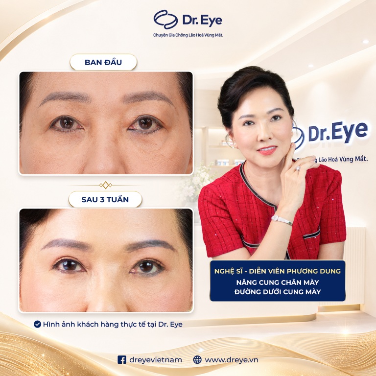 Phòng khám Chuyên khoa Thẩm mỹ Dr. Eye – Chuyên sâu chống lão hóa vùng mắt tại TPHCM Phòng khám Chuyên khoa Thẩm mỹ Dr. Eye – Chuyên sâu chống lão hóa vùng mắt tại TPHCM