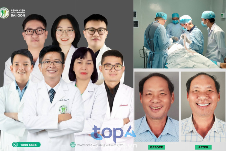 trồng răng implant tphcm trồng răng implant tphcm