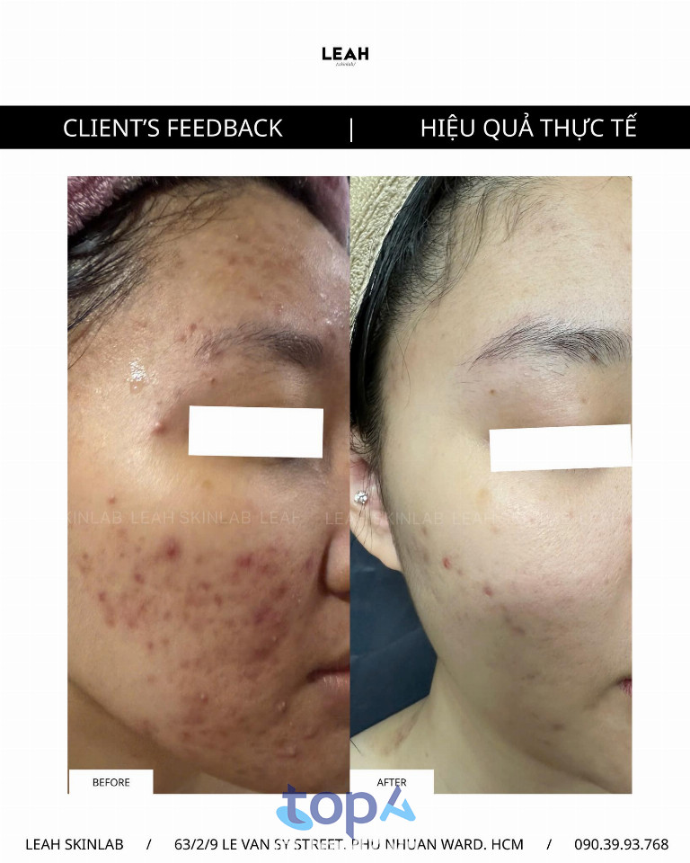 Spa tại quận Phú Nhuận Spa tại quận Phú Nhuận