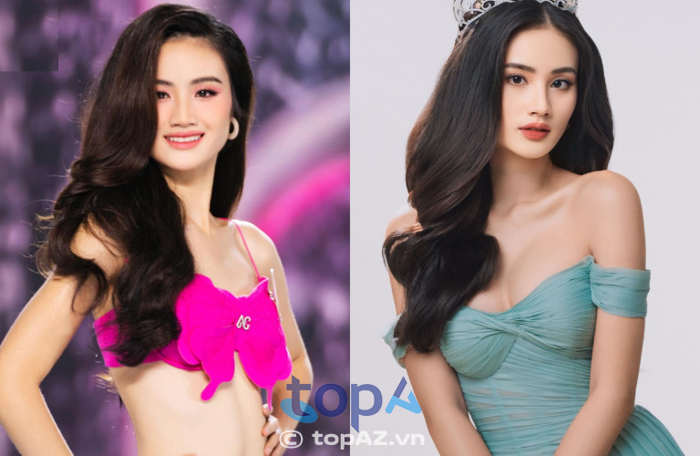 Hoa hậu Ý Nhi - Miss World Vietnam 2023 lựa chọn nâng ngực bác sĩ Khải