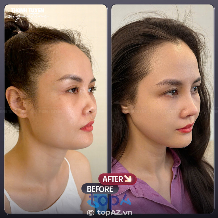 Thẩm mỹ Thanh Tuyền - P. Long Xuyên