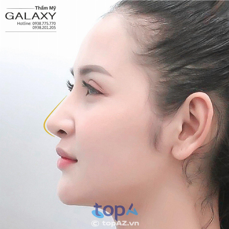 Nâng mũi điêu khắc Dr.Duy