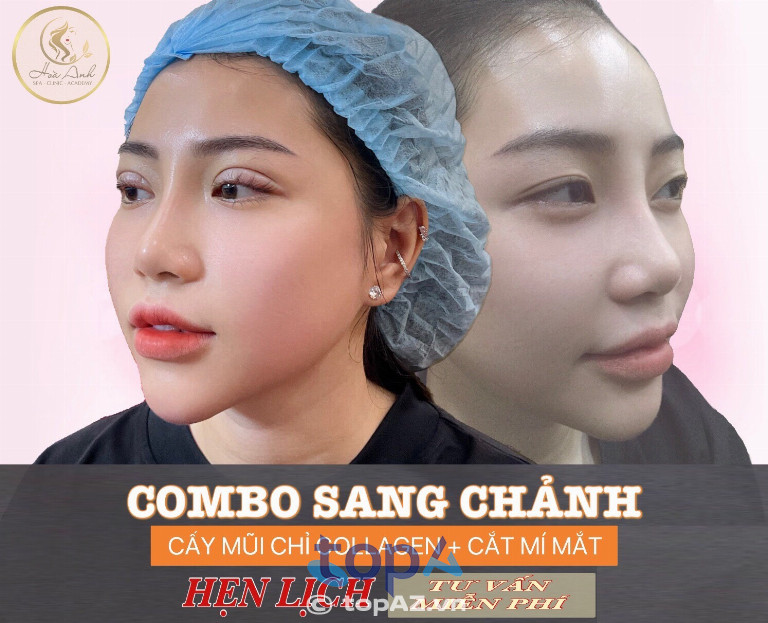 Thẩm mỹ Hoà Anh - P. Long Châu