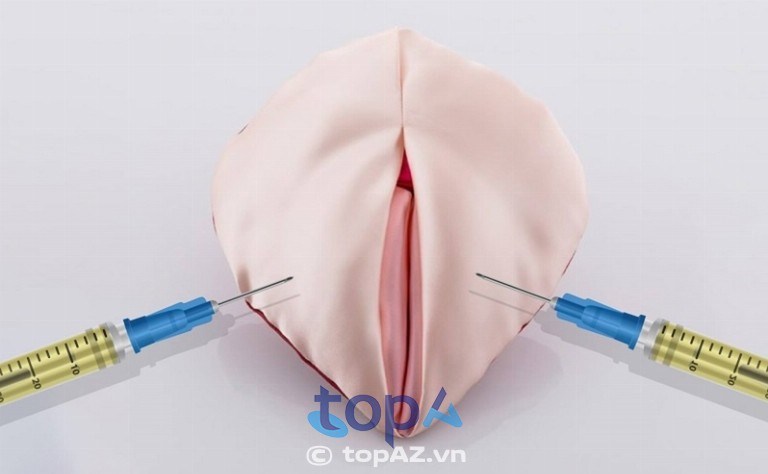 Đảm bảo sử dụng Filler chính hãng