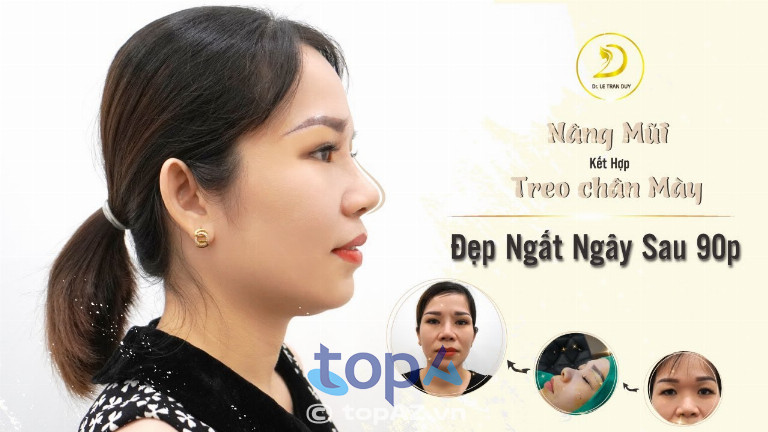 Nâng mũi và treo chân mày tại Thẩm mỹ viện Galaxy