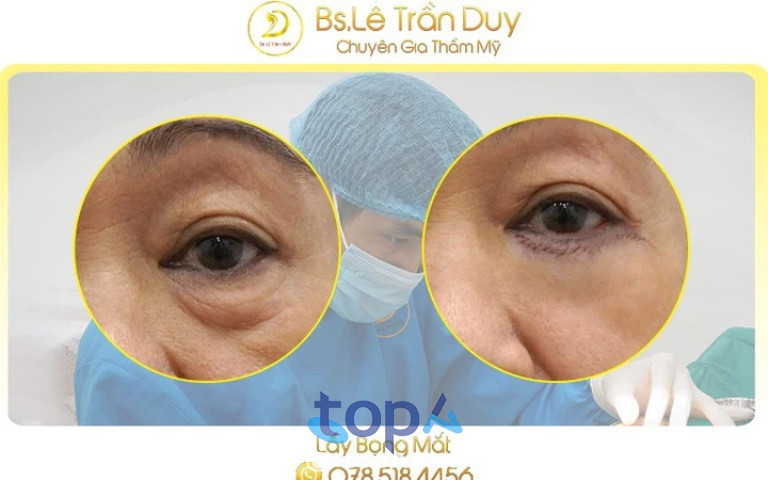 Bác sĩ Lê Trần Duy trực tiếp tư vấn và thực hiện