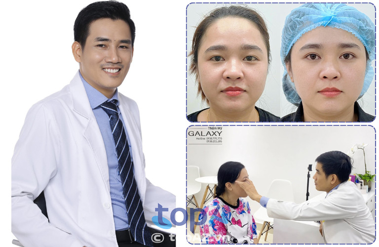 Dịch vụ cắt mí, nhấn mí tại Thẩm mỹ viện Galaxy