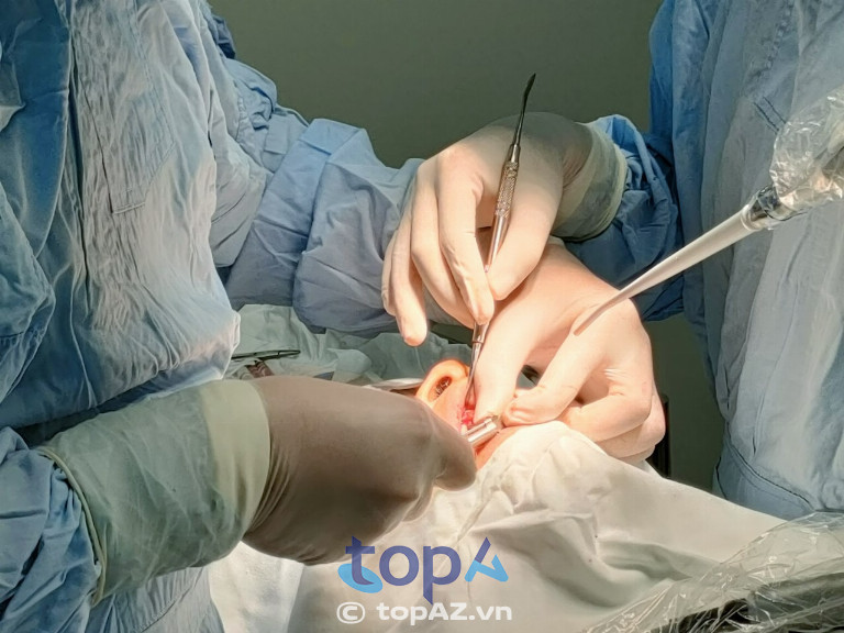 Tiến hành cấy ghép Implant