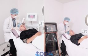 LG Clinic – Địa chỉ xóa nếp nhăn ấn đường