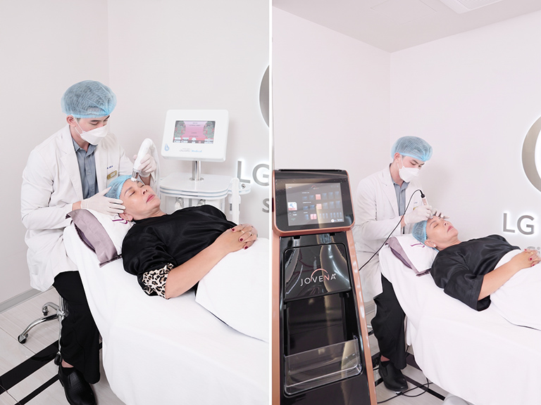 LG Clinic ứng dụng công nghệ CFU Èlife trong các liệu trình xóa nhăn ấn đường