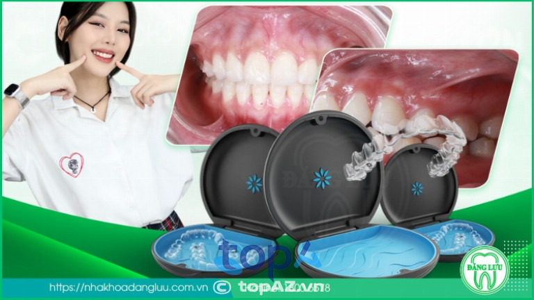 Niềng răng trong suốt Invisalign