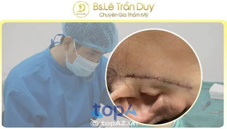 Đường khâu thẩm mỹ được bác sĩ Lê Trần Duy thực hiện