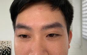 Địa chỉ điêu khắc chân mày Nam đẹp ở TPHCM